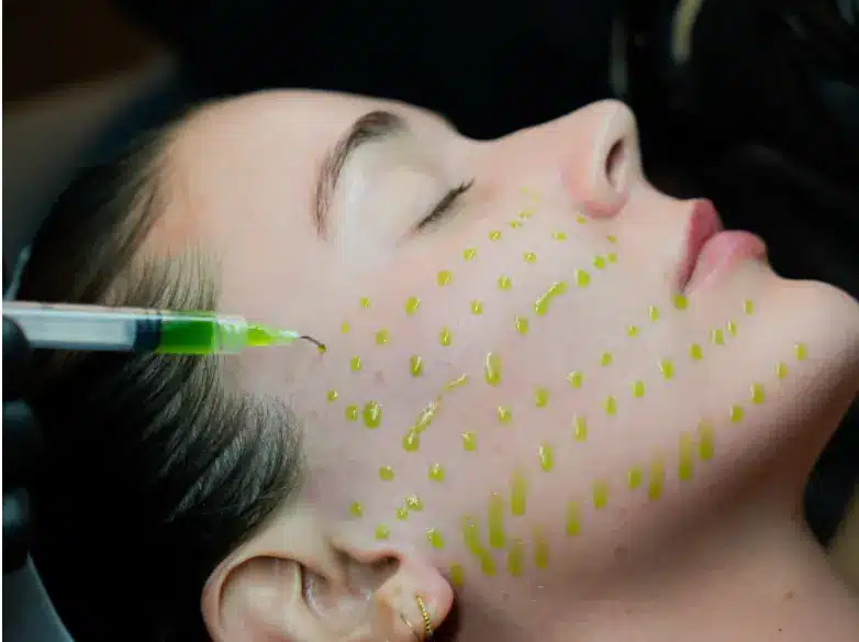 Bioreepeel
